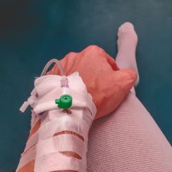 Až třetina těžkých pacientů s rakovinou dostává v Plzni biologickou léčbu