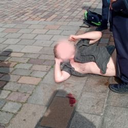 Chtěl napadnout městskou policistku, skončil s tržnou ránou na hlavě