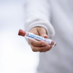 Klatovská a Domažlická nemocnice otestují pendlery