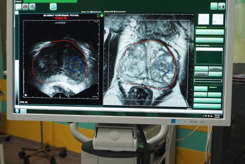 Foto: Nová technologie urologů FN Plzeň zachytí nádor přesněji 