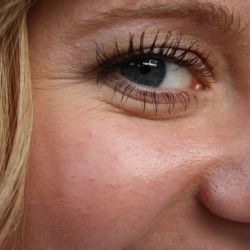 Obliba estetické dermatologie u žen i mužů stále roste