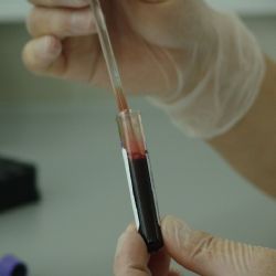 Otestujte se v Klatovech a Domažlicích zdarma a anonymně na HIV