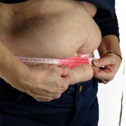 Chcete zhubnout? Přednáška ve FN se zaměří na obezitu