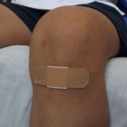 S prázdninami přibylo v nemocnicích kraje dětských úrazů