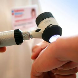 Zkontrolovat znaménka po létě je důležité. Přijďte do Polikliniky Agel