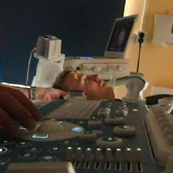 Aby nepřišli o práci, tají roztroušenou sklerózu