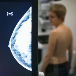 Adresné pozvánky na screeningy slaví úspěch. Zachránily životy