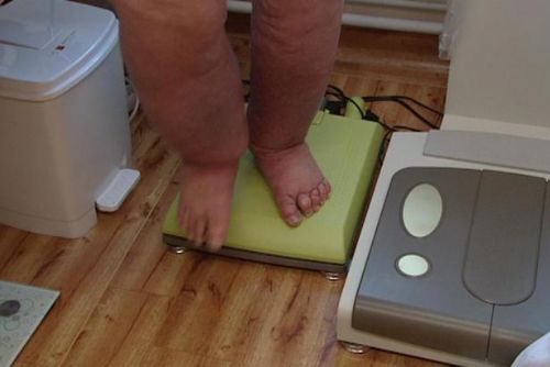 Foto: Hodně jíst a spát? Vláda chce s obezitou bojovat spíše pohybem