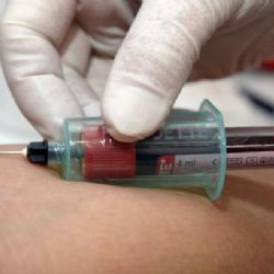 Kuba jako první vymýtila přenos HIV z matky na dítě