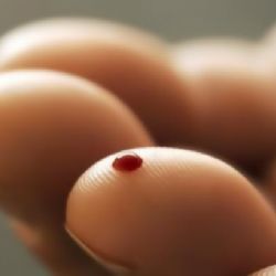 Lékaři hledají další dárce kostní dřeně. Vyzvali i zájemce z národnostních menšin
