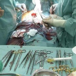 Muž s transplantovaným srdcem i plicemi půjde v únoru domů