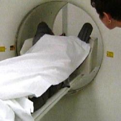 Rakovina zabíjí méně. Uspěl adresný screening, ale i doplňková léčba