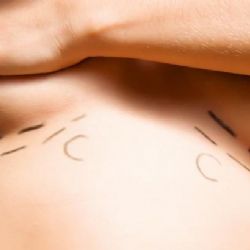 V Česku roste počet plastik – i těch nepovedených