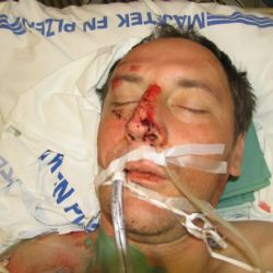 Policie neví, kdo je muž sražený na dálnici