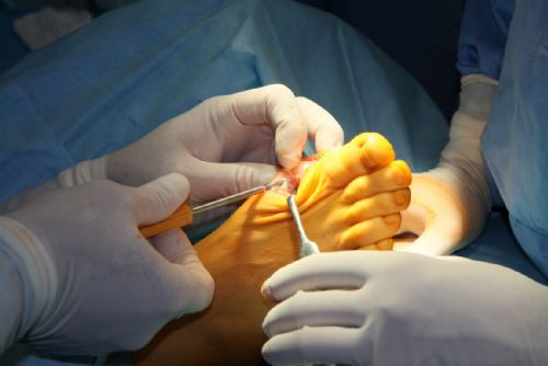 Foto: Jednodenní chirurgie Privamed už operuje deformace prstů 