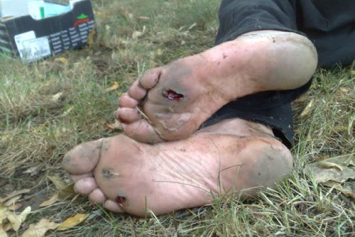 Foto: Podchlazený muž ležel v Plzni tři dny na trávníku