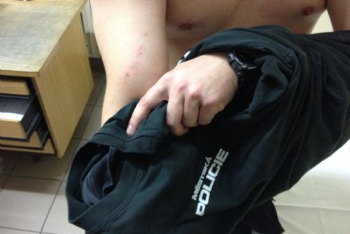 Foto: Agresivní opilec při převozu na záchytku napadl strážníka