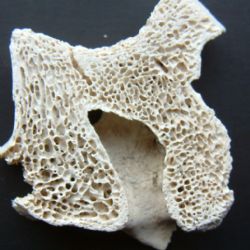 Pondělí je dnem proti osteoporóze
