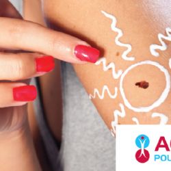 Zkontrolovat znaménka po létě je důležité. Celý měsíc je vyšetří Poliklinika AGEL Plzeň v rámci Měsíce prevence melanomu