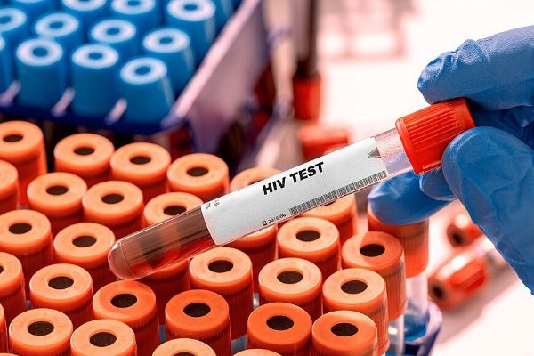 HIV v Česku dál přibývá. Případy nejsou jen ve velkých městech, týkají se i Plzeňského kraje
