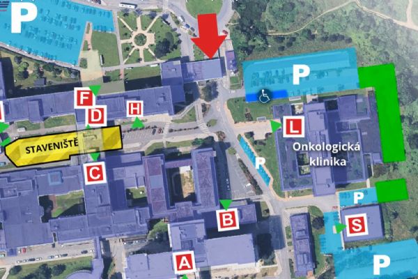 Míříte do FN Plzeň? Podívejte se, kudy nově projet areálem na Lochotíně