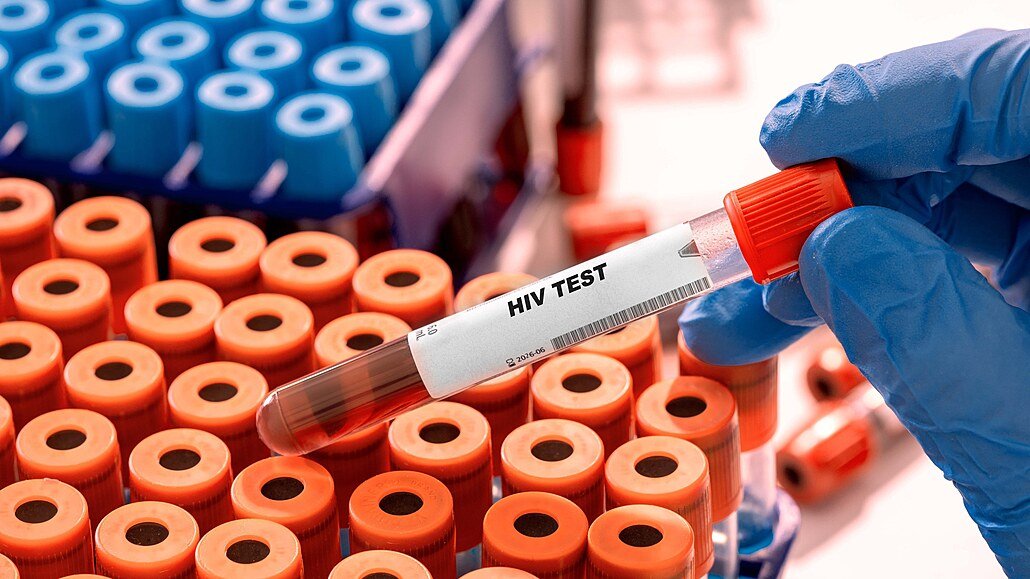 obrázek: HIV v Česku dál přibývá. Případy nejsou jen ve velkých městech, týkají se i Plzeňského kraje