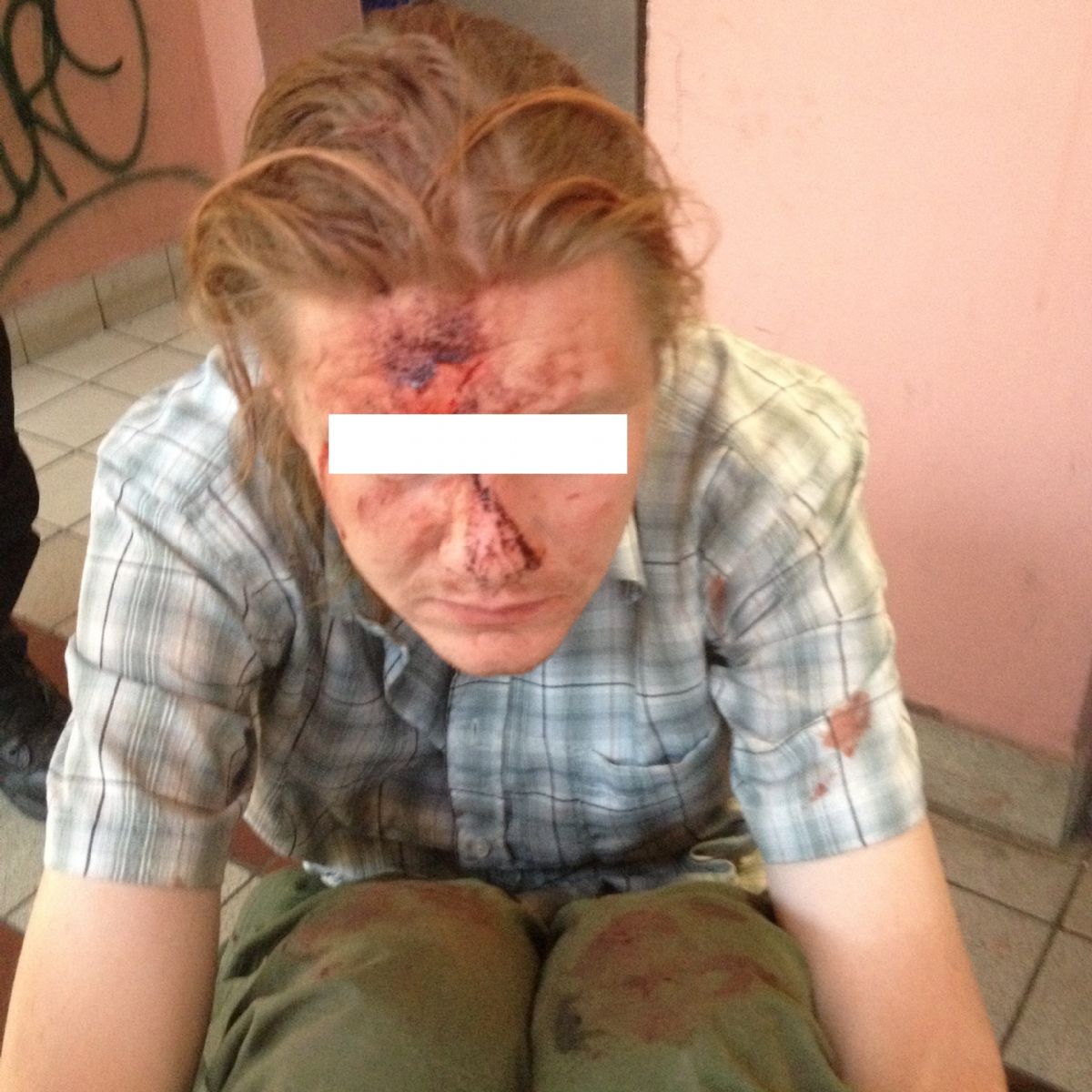 obrázek: Zraněný muž skončil v péči záchranářů