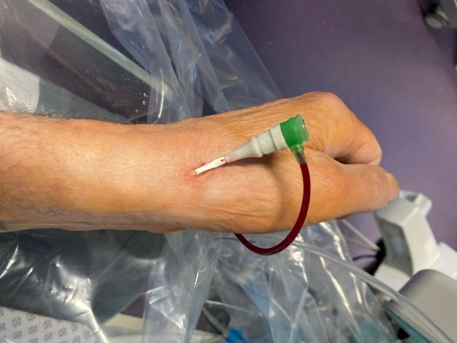 obrázek: Jednodenní kardiostacionář FN poskytl péči již 10 000 pacientům