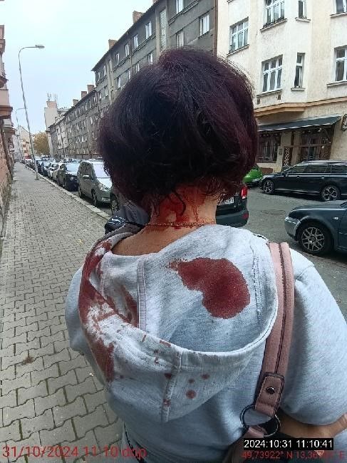 obrázek: Zraněná žena mířila do restaurace splatit dluh místo k lékaři