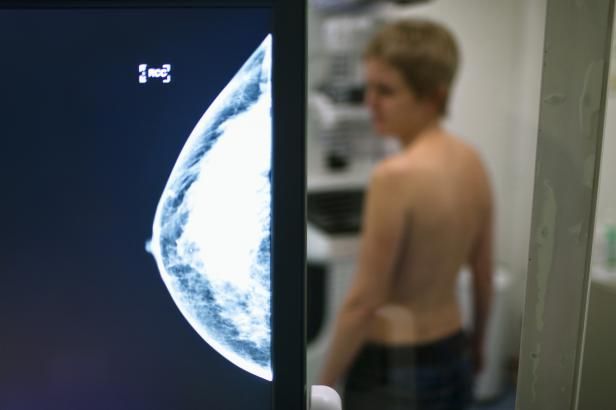 obrázek: Adresné pozvánky na screeningy slaví úspěch. Zachránily životy