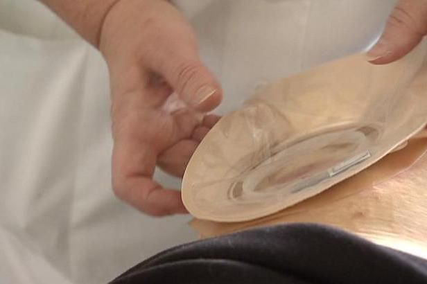 obrázek: Bezplatné zdravotnictví? Pro lidi s lupénkou či celiakií ne