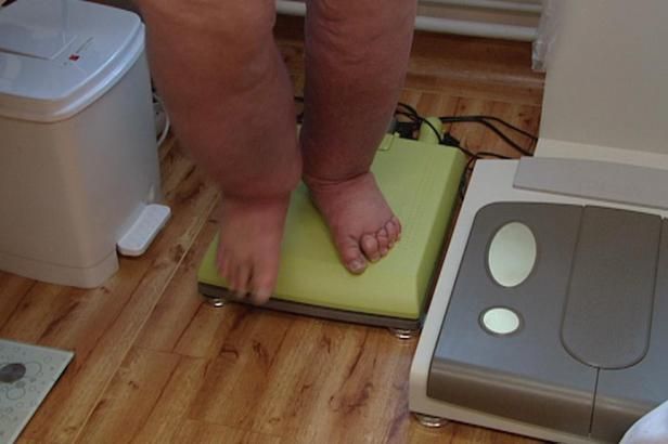 obrázek: Hodně jíst a spát? Vláda chce s obezitou bojovat spíše pohybem