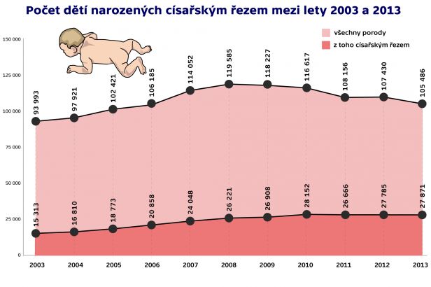 obrázek: Jsou císařské řezy byznys? Rodí tak každá čtvrtá Češka