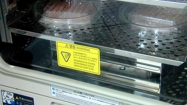 obrázek: \nLéčba diabetiků kmenovými buňkami má znovu zelenou\n