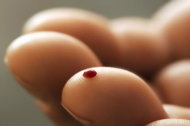 obrázek: Lékaři hledají další dárce kostní dřeně. Vyzvali i zájemce z národnostních menšin