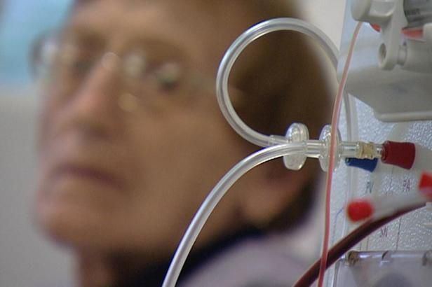 obrázek: Lidí s nemocnými ledvinami přibývá, důležitá je prevence