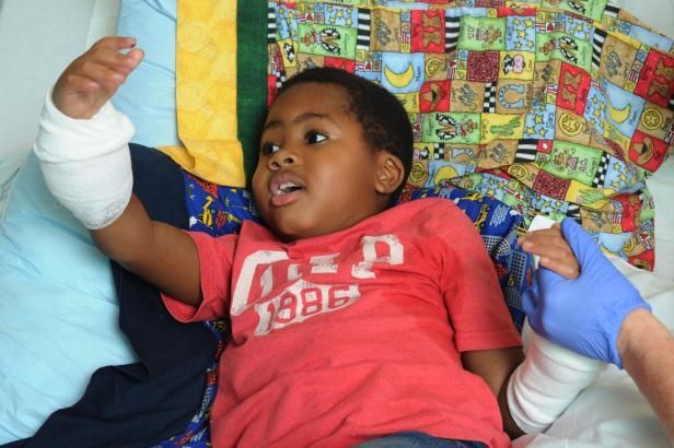 obrázek: Osmiletý Zion dostal nové ruce - jako nejmladší pacient