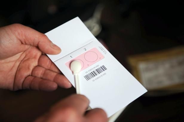 obrázek: Posmrtně odebrané DNA bez předchozího souhlasu nelze použít jako důkaz