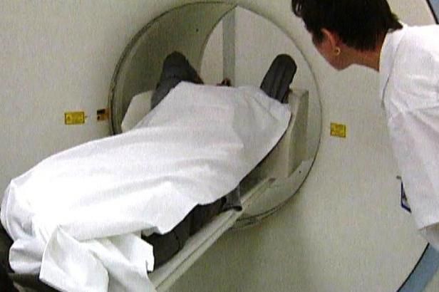 obrázek: Rakovina zabíjí méně. Uspěl adresný screening, ale i doplňková léčba