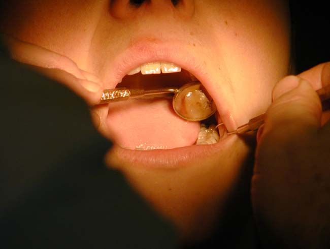 obrázek: Chřipka opět mizí