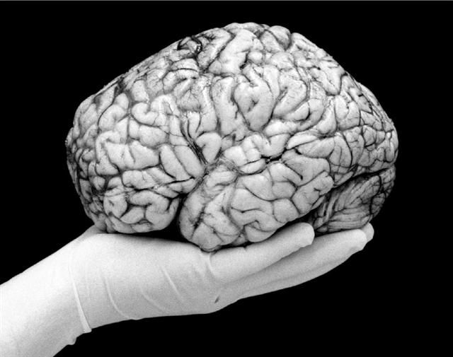 obrázek: Lékaři v Plzni budou zkoumat mozek alkoholiků