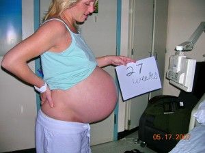 obrázek: Plzeň zachraňuje neplodné páry