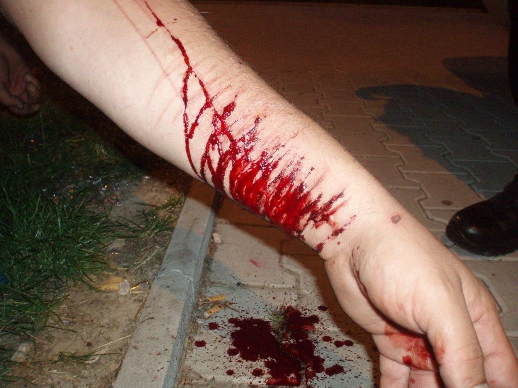 obrázek: Chtěl se zabít kvůli nešťastné lásce, zachránili ho strážníci