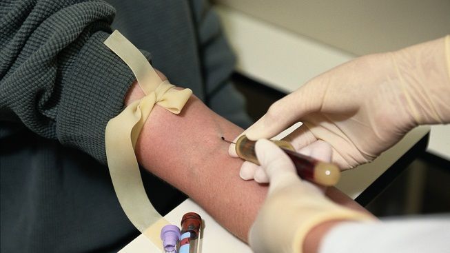 obrázek: Lesník ze Šumavy při odběru krve omdlel jako špalek