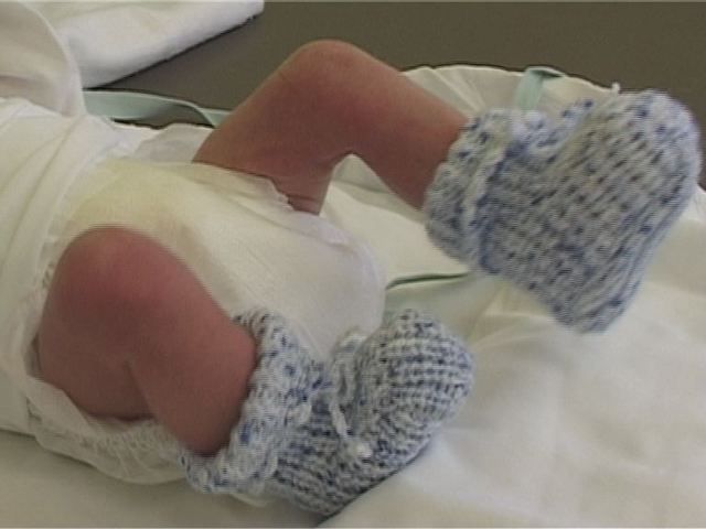 obrázek: V Plzni léčí dětské alergie už v porodnici