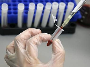 obrázek: Vyšetřit ledviny si nechalo 316 Plzeňáků