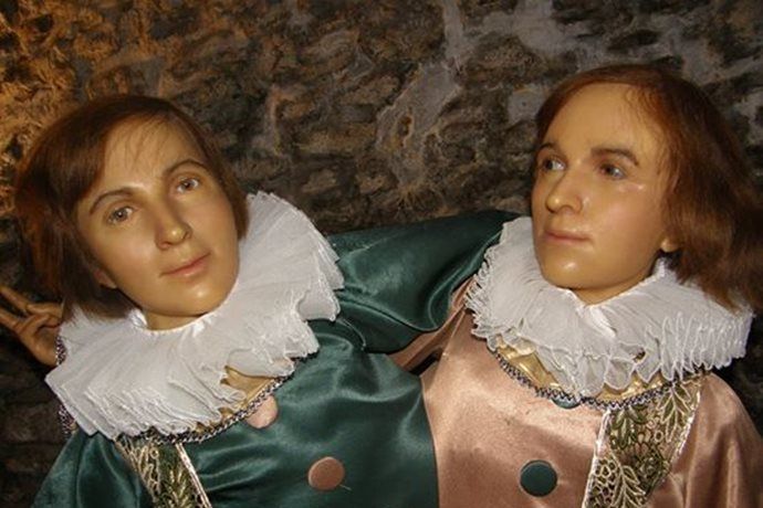 Siamská dvojčata nebo čtyřoký muž. V Plzni je k vidění výstava Katastrofy lidského těla  