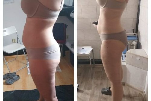 Foto: Beauty salon Plzeň nabízí zábaly Body Wraps ® s garancí úbytku minimálně 5 cm