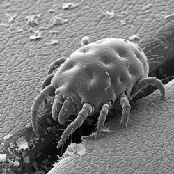 Na sušické základce se objevil svrab, Plzeňský kraj má dlouhodobě vysoký výskyt