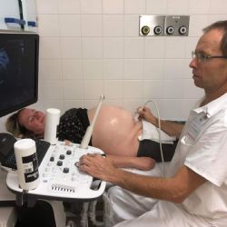 Gynekologické oddělení v Domažlicích umí rychlou hysteroskopii bez narkózy